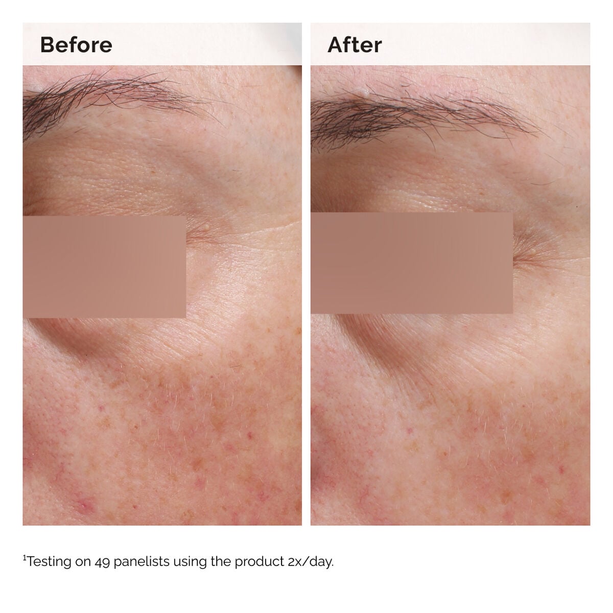 niacinamide-5-face-and-body-emulsion-b3 2024-08-23-ORD-Nia-5pct-Face-Body-B-A-Elasticity-Global-02-1x1.jpg