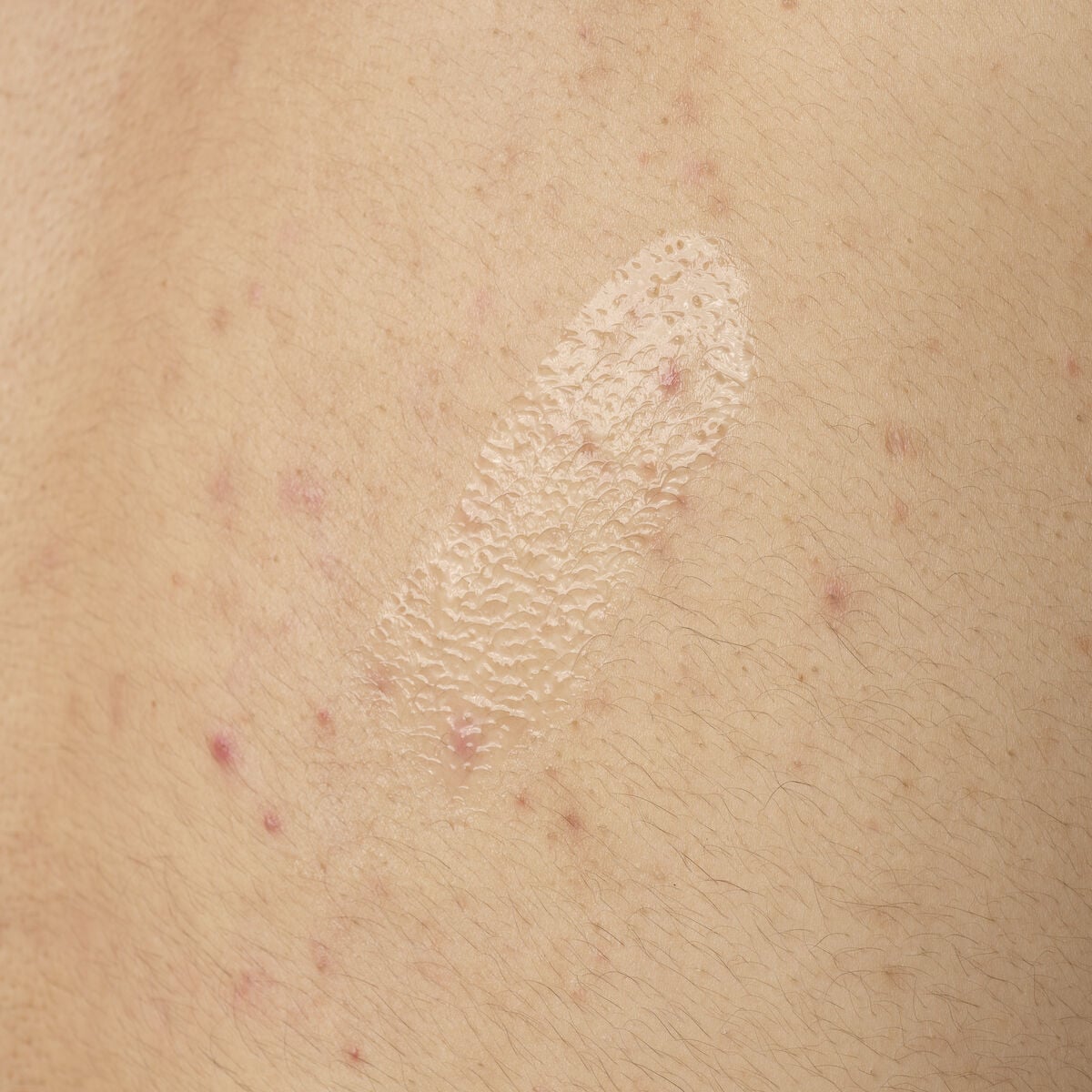 salicylic-acid-0-5-body-serum-d9 ORD-salicylic-acid-05-body-240ml-application.jpg