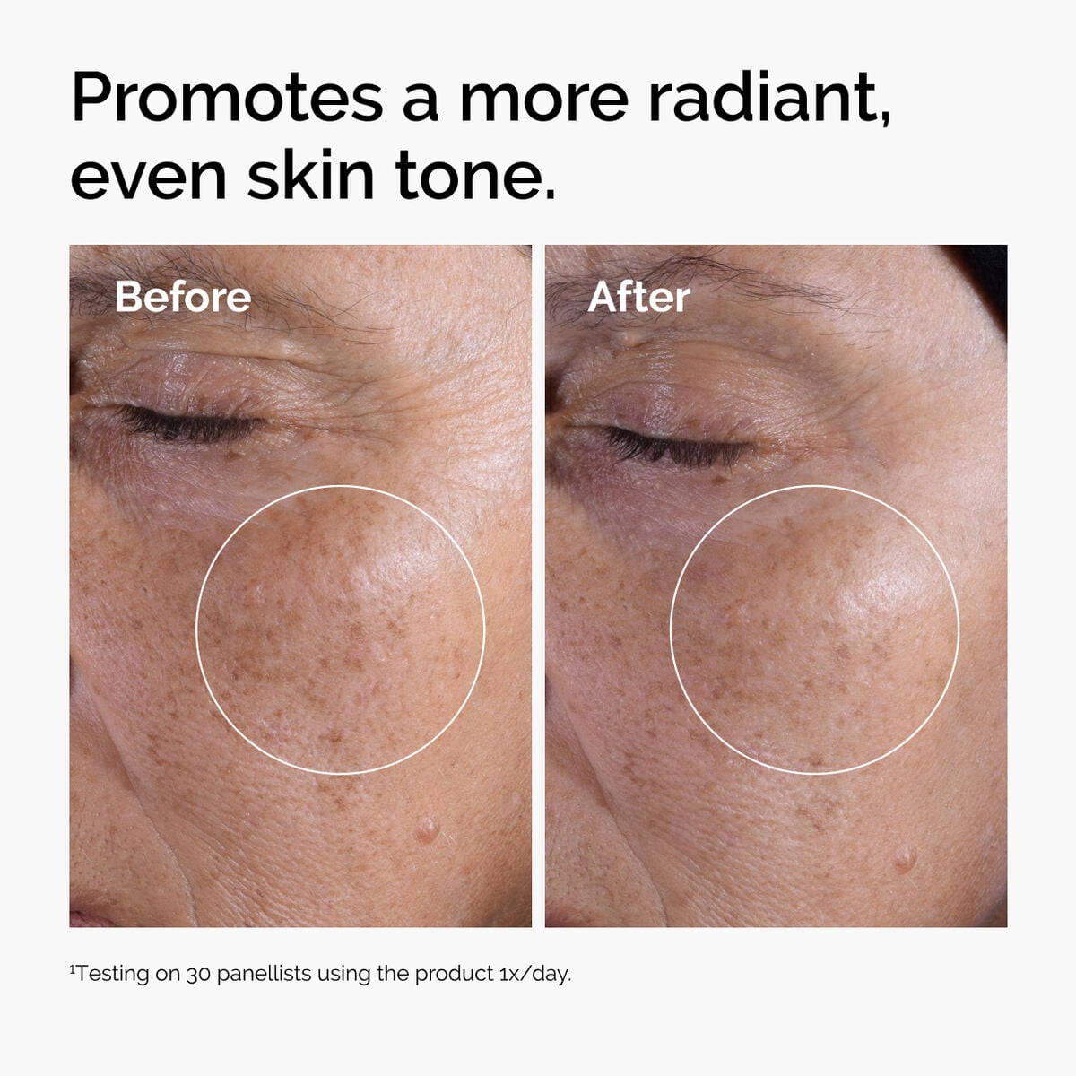 glycolic-acid-7-exfoliating-toner-l5 ord-glycolic-before-after-radiance.jpg