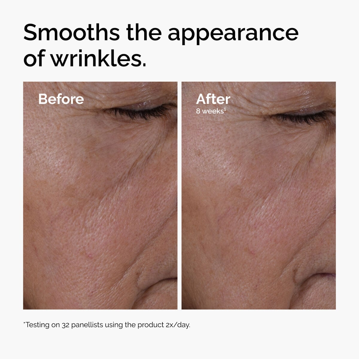 multi-peptide-ha-serum-c8 ord-multi-peptide-ha-serum-wrinkles-before-after.jpg