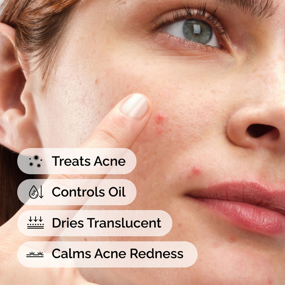 sulfur-10-powder-to-cream-concentrate-k7 ord-sulfur-10pct-powder-to-cream-concentrate-model-application-with-benefits-acne.jpg
